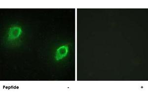 Immunofluorescence analysis of HeLa cells, using AKAP5 polyclonal antibody . (AKAP5 antibody  (N-Term))