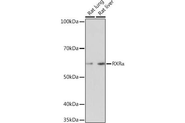 Retinoid X Receptor alpha antibody