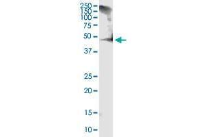 RCN1 monoclonal antibody (M01), clone 1F8-E4. (RCN1 antibody  (AA 31-331))