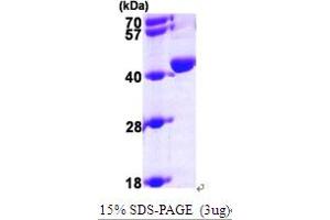 SDS-PAGE (SDS) image for Uroporphyrinogen Decarboxylase (UROD) (AA 1-367) protein (His tag) (ABIN667032) (UROD Protein (AA 1-367) (His tag))