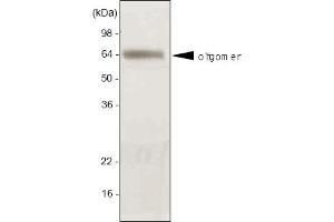 Western blot analysis. (ADIPOQ antibody  (AA 15-244))