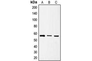 Western blot analysis of SRSF4 expression in HeLa (A), HT1080 (B), NIH3T3 (C) whole cell lysates. (SRSF4 antibody  (Center))