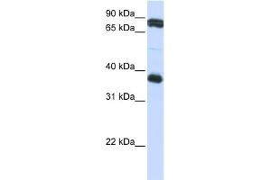 WB Suggested Anti-GP6 Antibody Titration:  0. (GP6 antibody  (Middle Region))