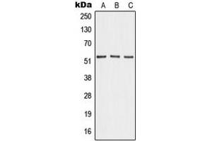 Western blot analysis of Angiopoietin-4 expression in HEK293T (A), mouse lung (B), PC12 (C) whole cell lysates. (Angiopoietin 4 antibody  (Center))