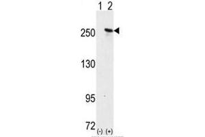 Image no. 1 for anti-Microtubule-Associated Protein 2 (MAP2) (C-Term) antibody (ABIN357399) (MAP2 antibody  (C-Term))