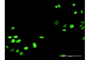 Immunofluorescence of purified MaxPab antibody to RECQL on HeLa cell. (RecQ Protein-Like (DNA Helicase Q1-Like) (RECQL) (AA 1-649) antibody)