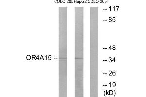Western Blotting (WB) image for anti-Olfactory Receptor, Family 4, Subfamily A, Member 15 (OR4A15) (C-Term) antibody (ABIN1853230) (OR4A15 antibody  (C-Term))