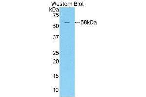 Western Blotting (WB) image for anti-Killer Cell Immunoglobulin-Like Receptor 2DS2 (KIR2DS2) (AA 22-304) antibody (ABIN1859539) (KIR2DS2 antibody  (AA 22-304))