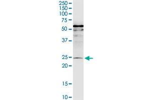 MIS12 monoclonal antibody (M01), clone 1G3. (MIS12 antibody  (AA 1-205))