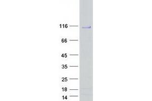 Western Blotting (WB) image for Death-Domain Associated Protein (DAXX) (Transcript Variant 3) protein (Myc-DYKDDDDK Tag) (ABIN2719322)