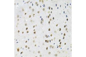 Immunohistochemistry of paraffin-embedded mouse brain using PPP1CA antibody. (PPP1CA antibody)