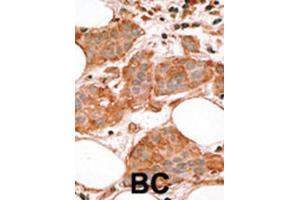Immunohistochemistry (IHC) image for anti-BCL2-Like 14 (Apoptosis Facilitator) (BCL2L14) (BH3 Domain) antibody (ABIN2997105) (BCL2L14 antibody  (BH3 Domain))