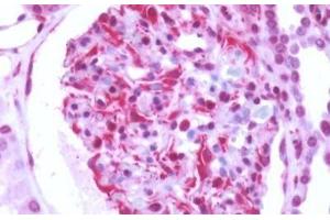 Human Kidney: Formalin-Fixed, Paraffin-Embedded (FFPE) (GPRC5B antibody  (N-Term))