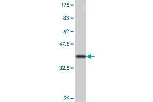 Western Blot detection against Immunogen (37. (CTNNAL1 antibody  (AA 277-380))