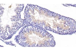 Immunohistochemistry (IHC) image for anti-Histone Deacetylase 6 (HDAC6) (AA 560-811) antibody (ABIN7439288)