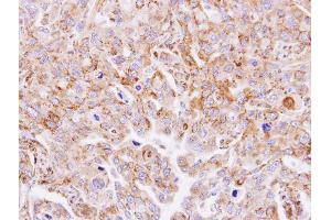 Immunohistochemistry (IHC) image for anti-Mannosyl (Beta-1,4-)-Glycoprotein beta-1,4-N-Acetylglucosaminyltransferase (MGAT3) antibody (ABIN2856848)
