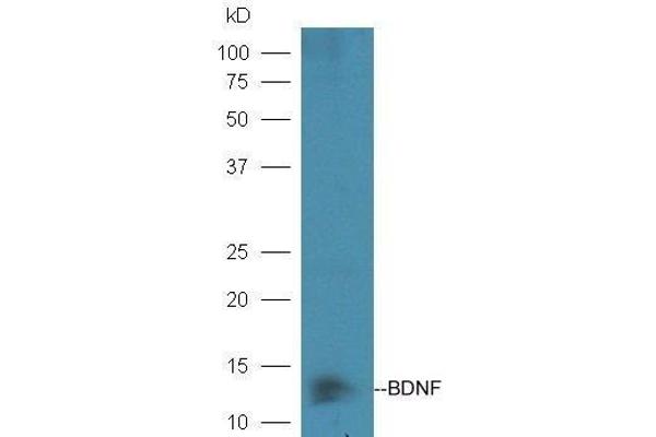 BDNF 抗体  (AA 151-247)