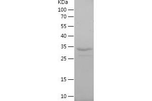 Western Blotting (WB) image for Solute Carrier Family 22 Member 6 (SLC22A6) (AA 460-563) protein (His-IF2DI Tag) (ABIN7283801) (SLC22A6 Protein (AA 460-563) (His-IF2DI Tag))
