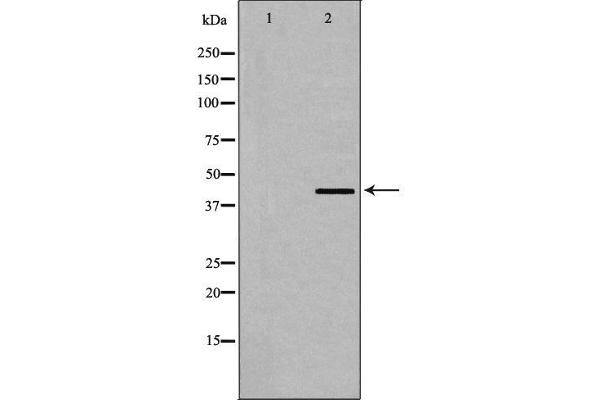 Dematin antibody  (C-Term)