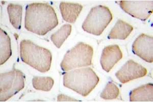 Image no. 1 for anti-CASP8 and FADD-Like Apoptosis Regulator (CFLAR) antibody (ABIN272307) (FLIP antibody)