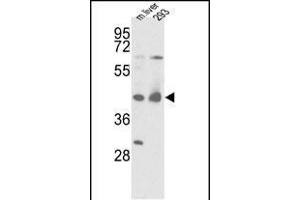 Western blot analysis of IDH1 Antibody (N-term) (ABIN391659 and ABIN2841570) in mouse liver tissue and 293 cell line lysates (35 μg/lane). (IDH1 antibody  (N-Term))