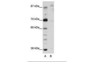 GLIS3 antibody  (N-Term)
