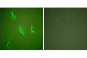Immunofluorescence analysis of HeLa cells, using Caspase 10 Antibody. (Caspase 10 antibody  (AA 430-479))