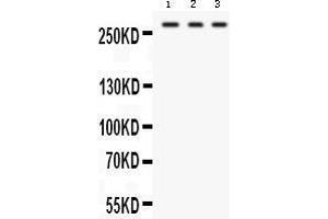 Western blot analysis of FASN expression in HEPG2 whole cell lysates (lane 1), U87 whole cell lysates (lane 2) and RAJI whole cell lysates (lane 3). (Fatty Acid Synthase antibody  (AA 1-226))