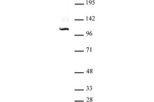 GLI1 antibody (pAb) tested by Western blot. (GLI1 antibody  (C-Term))