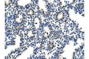 PCBP2 antibody was used for immunohistochemistry at a concentration of 4-8 ug/ml to stain Alveolar cells (arrows) in Human Lung. (PCBP2 antibody)