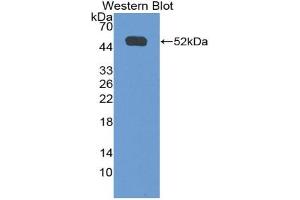 Western blot analysis of the recombinant protein. (IFNGR1 antibody  (AA 23-253))