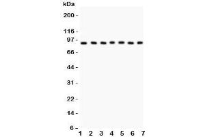 Western blot testing of MSK1 antibody and Lane 1:  human placenta;  2: rat brain;  3: (h) Jurkat;  4: (h) HeLa;  5: (h) PANC;  6: (h) A549;  7: (h) HEPG2.