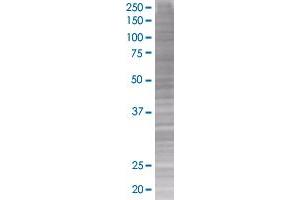 CDK4 transfected lysate (CDK4 293T Cell Transient Overexpression Lysate(Denatured))