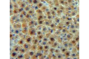 Used in DAB staining on fromalin fixed paraffin-embedded liver tissue (Transferrin antibody  (AA 360-683))
