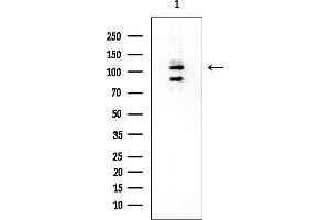 anti-Cancer Susceptibility Candidate 3 (CASC3) (Internal Region) antibody