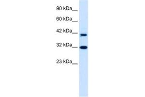 Western Blotting (WB) image for anti-D4, Zinc and Double PHD Fingers Family 1 (DPF1) antibody (ABIN2460940) (DPF1 antibody)