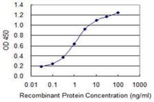 Detection limit for recombinant GST tagged UPK1B is 0. (Uroplakin 1B antibody  (AA 131-228))
