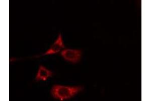 ABIN6275794 staining Hela cells by IF/ICC. (MYL7 antibody)