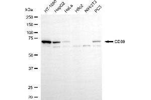 Western blotting analysis using CD89 antibody (ABIN7798588).