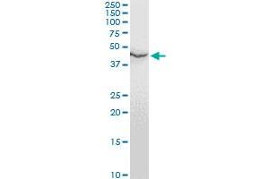 ENO1 monoclonal antibody (M07A), clone 8G3. (ENO1 antibody  (AA 1-434))