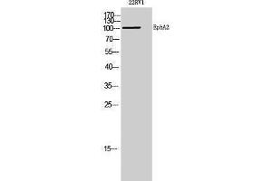 Western Blotting (WB) image for anti-EPH Receptor A2 (EPHA2) (N-Term) antibody (ABIN3174969) (EPH Receptor A2 antibody  (N-Term))