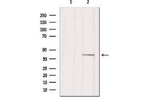 Western blot analysis of extracts from HUVEC, using ZDHHC18 Antibody. (ZDHHC18 antibody  (N-Term))