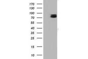 HEK293T cells were transfected with the pCMV6-ENTRY control (Left lane) or pCMV6-ENTRY TCTN2 (Right lane) cDNA for 48 hrs and lysed. (TCTN2 antibody)