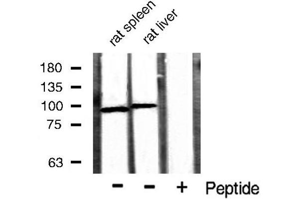 CTNNB1 antibody  (N-Term)