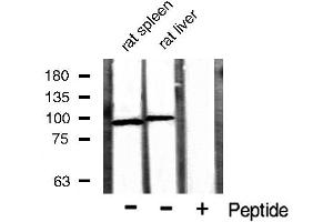 Western blot analysis of extracts of various sample,using Catenin-β antibody. (CTNNB1 antibody  (N-Term))