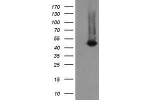 Image no. 1 for anti-Chromosome 2 Open Reading Frame 62 (C2orf62) antibody (ABIN1497051)