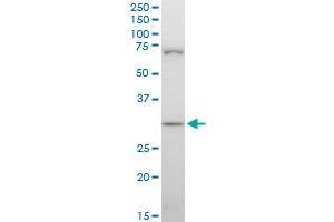 STOM polyclonal antibody (A01), Lot # 060717JCS1. (Stomatin antibody  (AA 59-142))