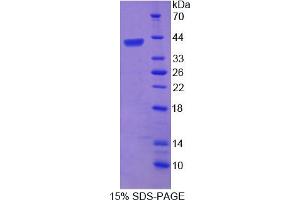 Image no. 1 for Telomeric Repeat Binding Factor 2 (TERF2) (AA 144-438) protein (His tag) (ABIN6237389)