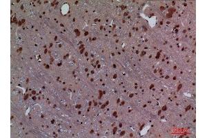 Immunohistochemistry (IHC) analysis of paraffin-embedded Rat Brain, antibody was diluted at 1:100. (HOXD3 antibody  (Internal Region))