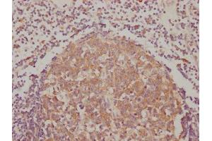 IHC image of ABIN7127362 diluted at 1:90 and staining in paraffin-embedded human lymph node tissue performed on a Leica BondTM system. (Recombinant BAK1 antibody)